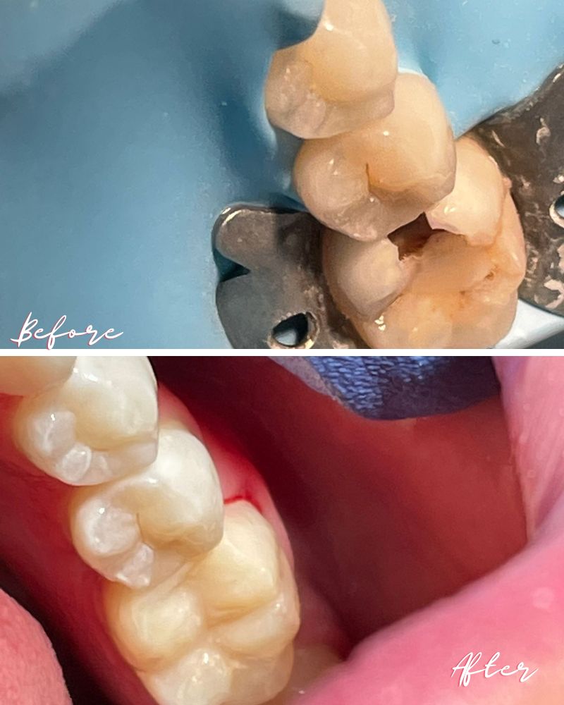 Lismore House Dental Practice Mark Fortune Before & after treatment with Mark