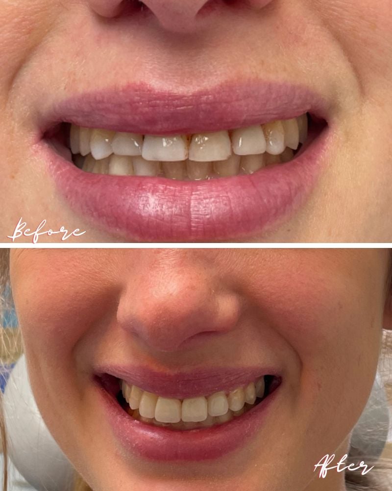 Lismore House Dental Practice Mark Fortune Before & after treatment with Mark