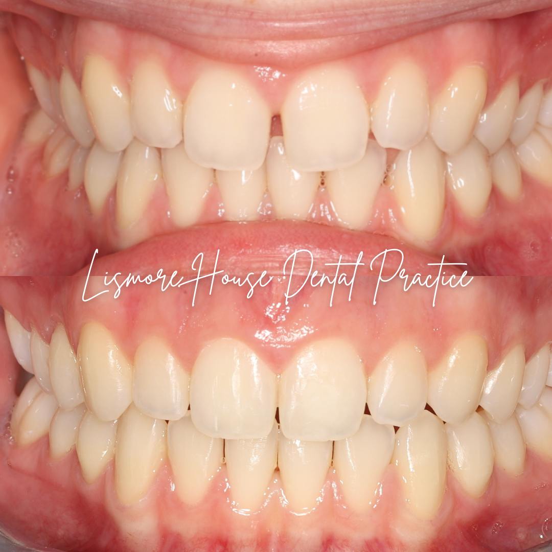 Lismore House Dental Practice Straight Teeth at Lismore Carlisle Lismore House Dental Practice Straight Teeth at Lismore Carlisle