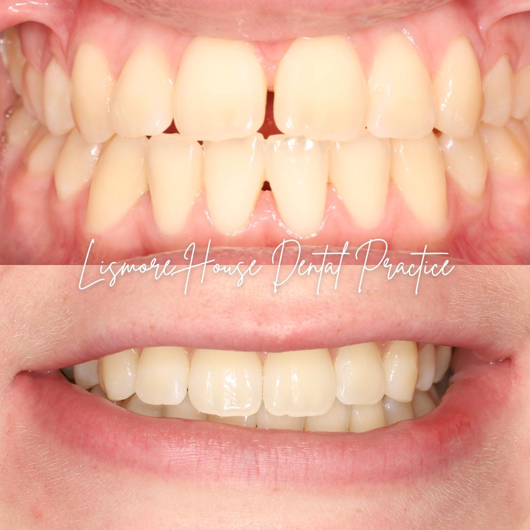 Lismore House Dental Practice Straight Teeth at Lismore Carlisle Lismore House Dental Practice Straight Teeth at Lismore Carlisle