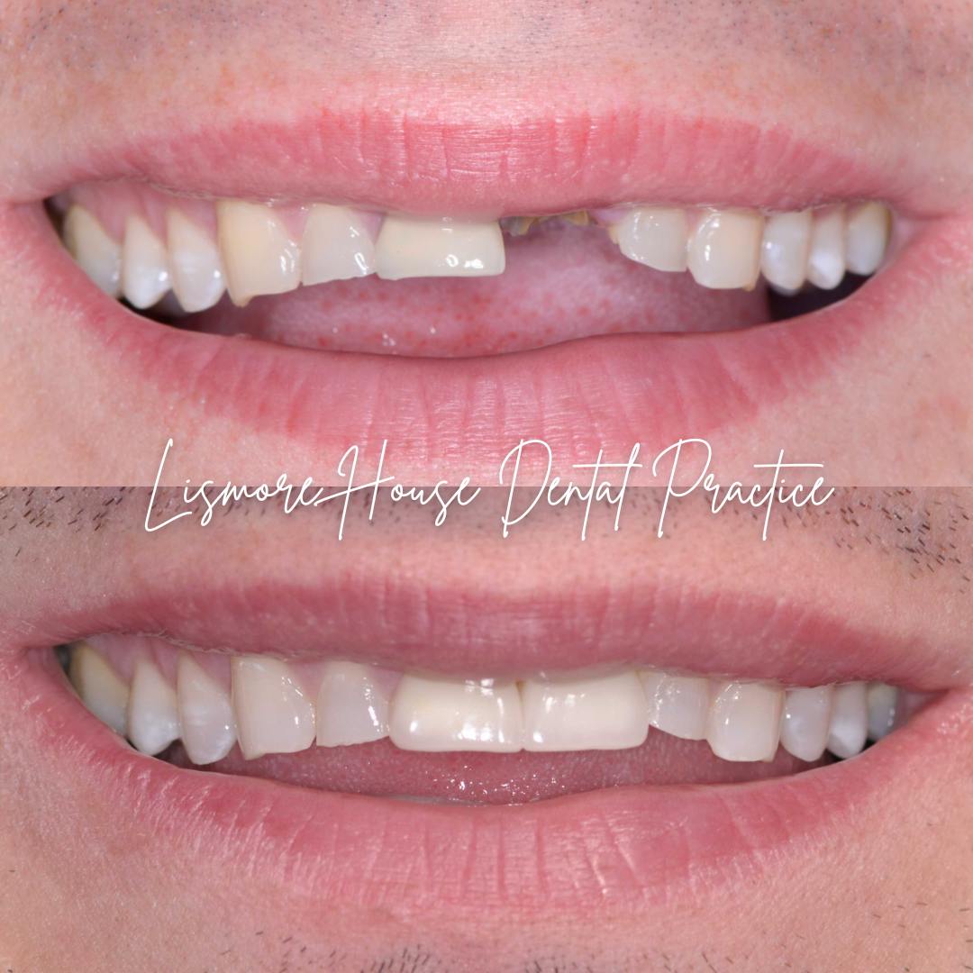 Lismore House Dental Practice Smile Gallery Lismore House Dental Practice Smile Gallery