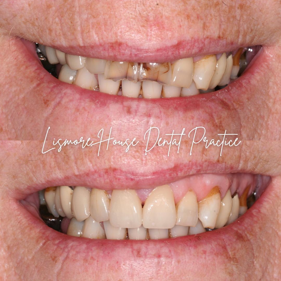 Lismore House Dental Practice Smile Gallery Lismore House Dental Practice Smile Gallery