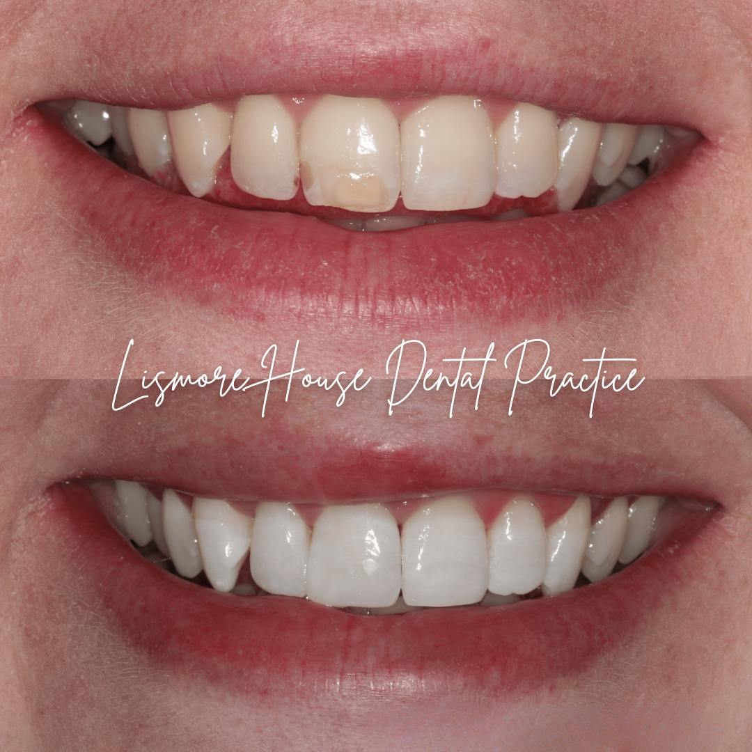 Lismore House Dental Practice Smile Makeovers in Carlisle Lismore House Dental Practice Smile Makeovers in Carlisle