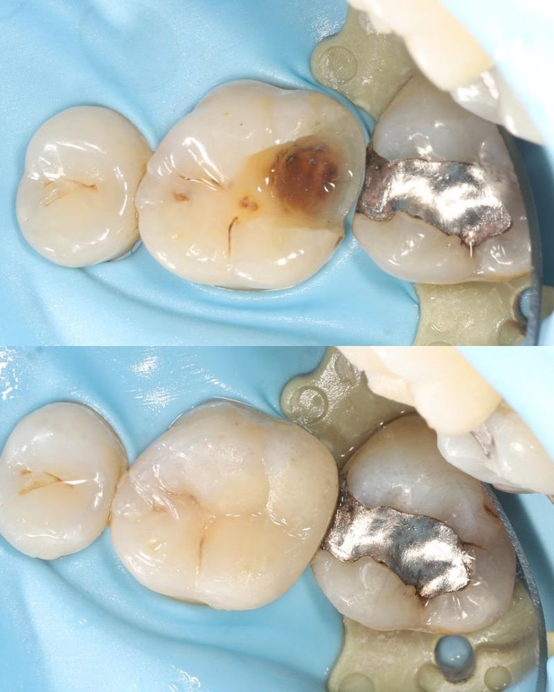 Lismore House Dental Practice Matt Gribbon Before & after treatment with Matt