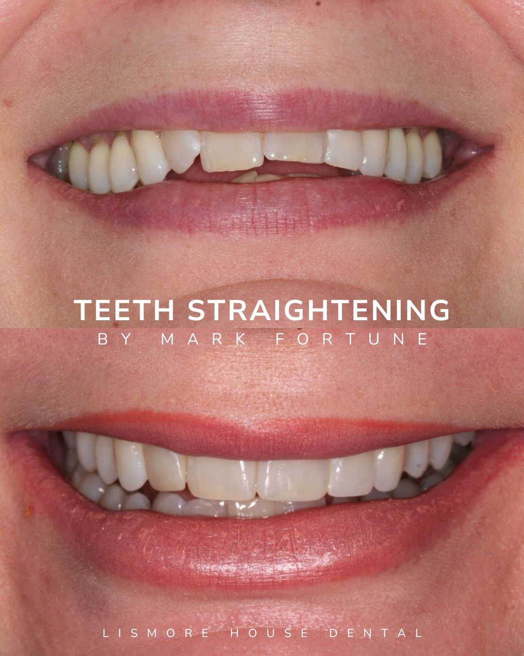 Lismore House Dental Practice Straight Teeth at Lismore Carlisle Teeth Straightening
